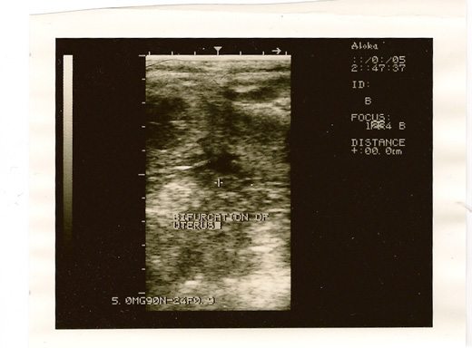 Mare Uterus